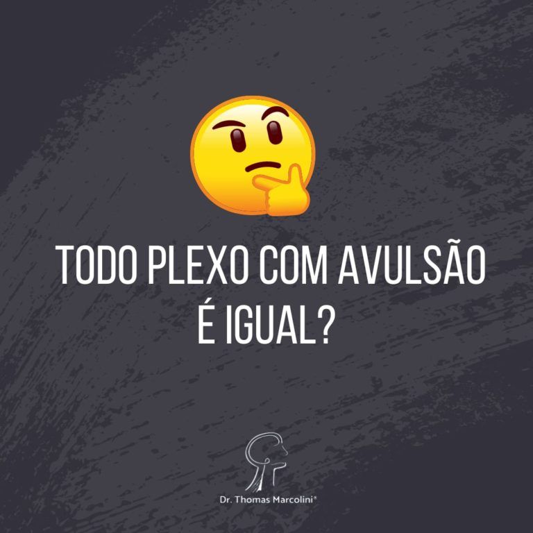 Todo plexo com avulsão é igual