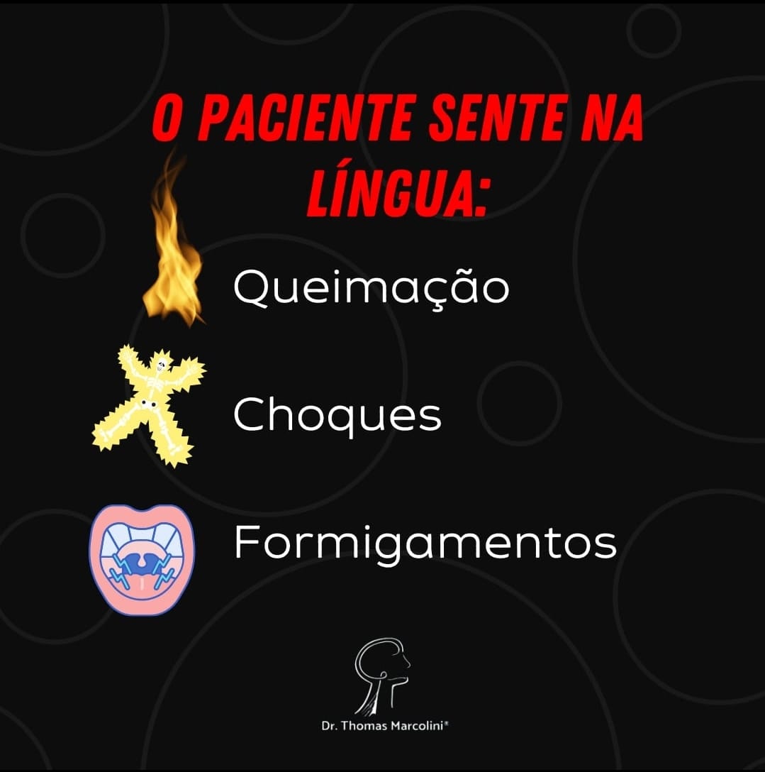 Língua queima após tirar o siso.