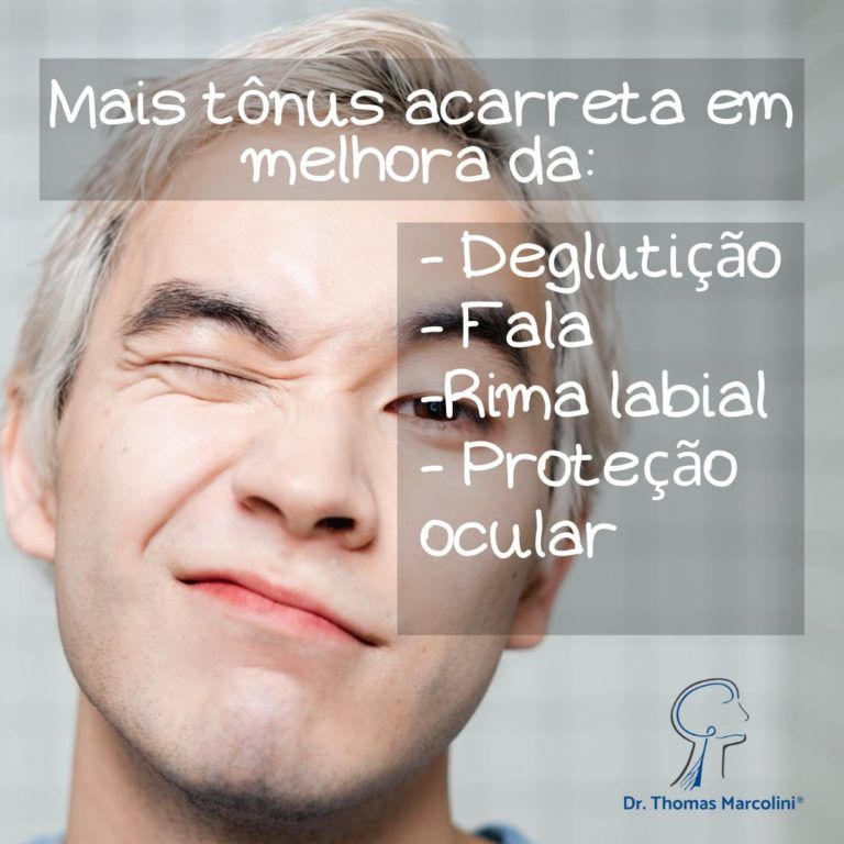 Melhora do tônus da face fisioterapia do rosto para lesão do nervo facial