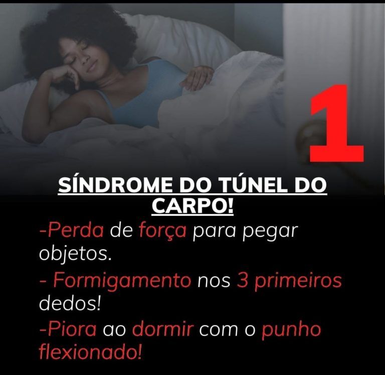 síndrome do túnel do carpo