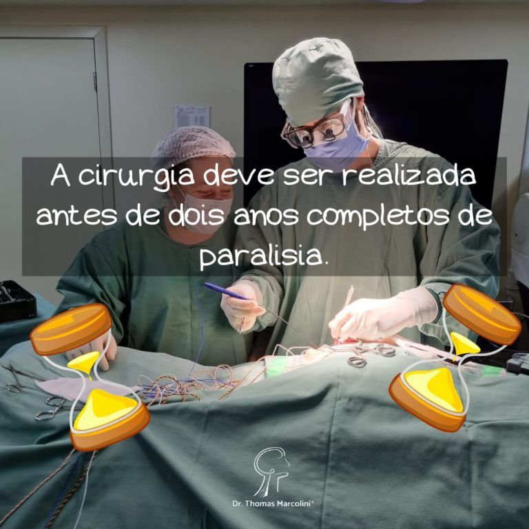 Quanto tempo depois da paralisia facial posso fazer cirurgia?