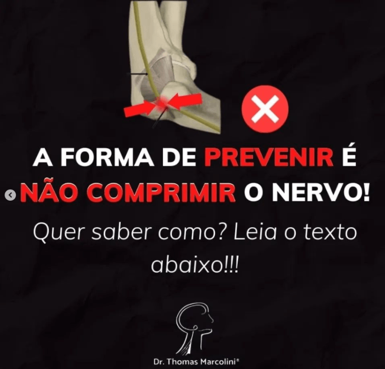 Comprirmir o nervo não previne lesões