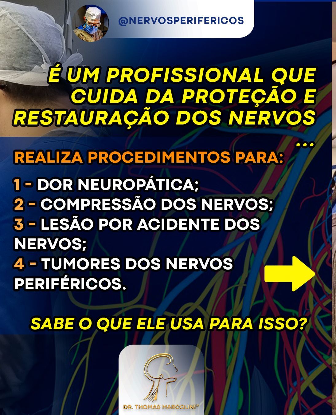 Especialista em Nervos Periféricos em são paulo