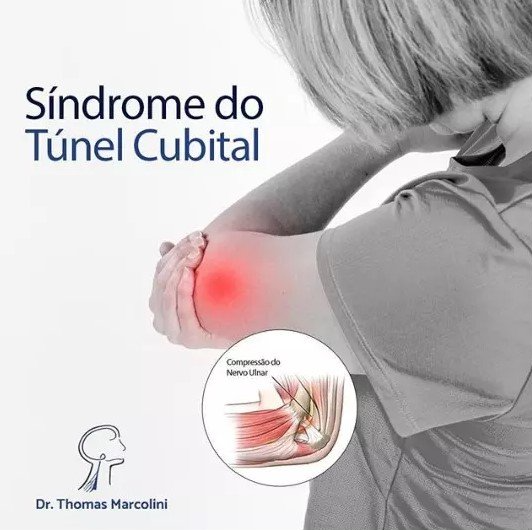 Médico Especialista em Cirurgia do Túnel Cubital