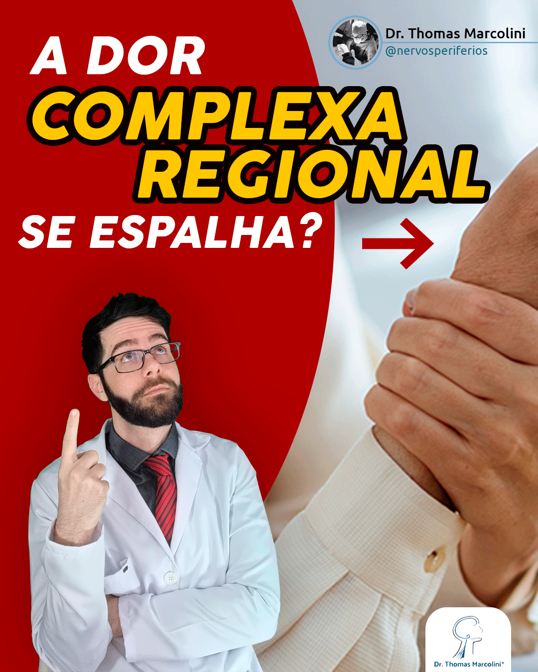 A dor complexa regional se espalha?