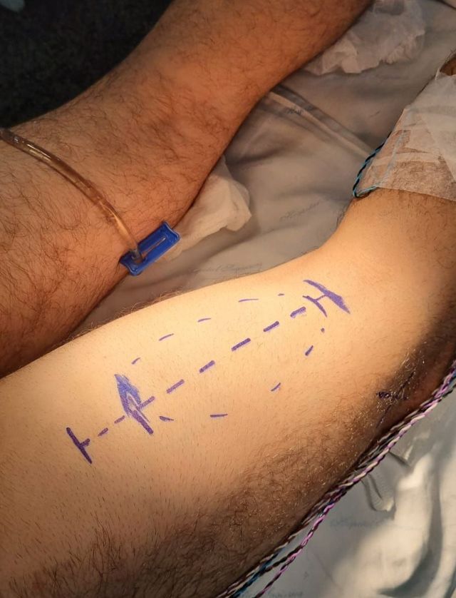 lipo-c injection dosage per week for weight loss Lipo-Mino-Mix-C