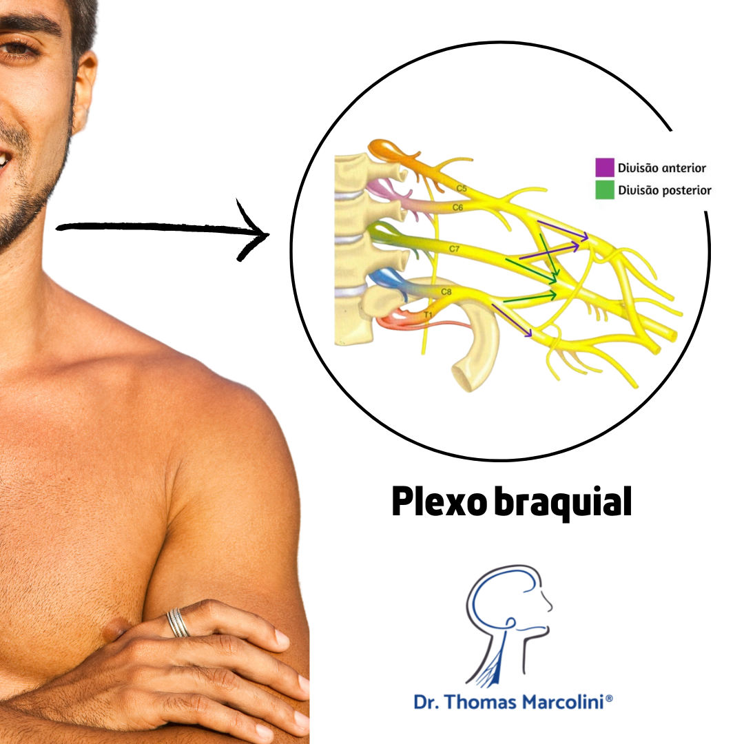 Guia completo sobre a Lesão do Plexo Braquial
