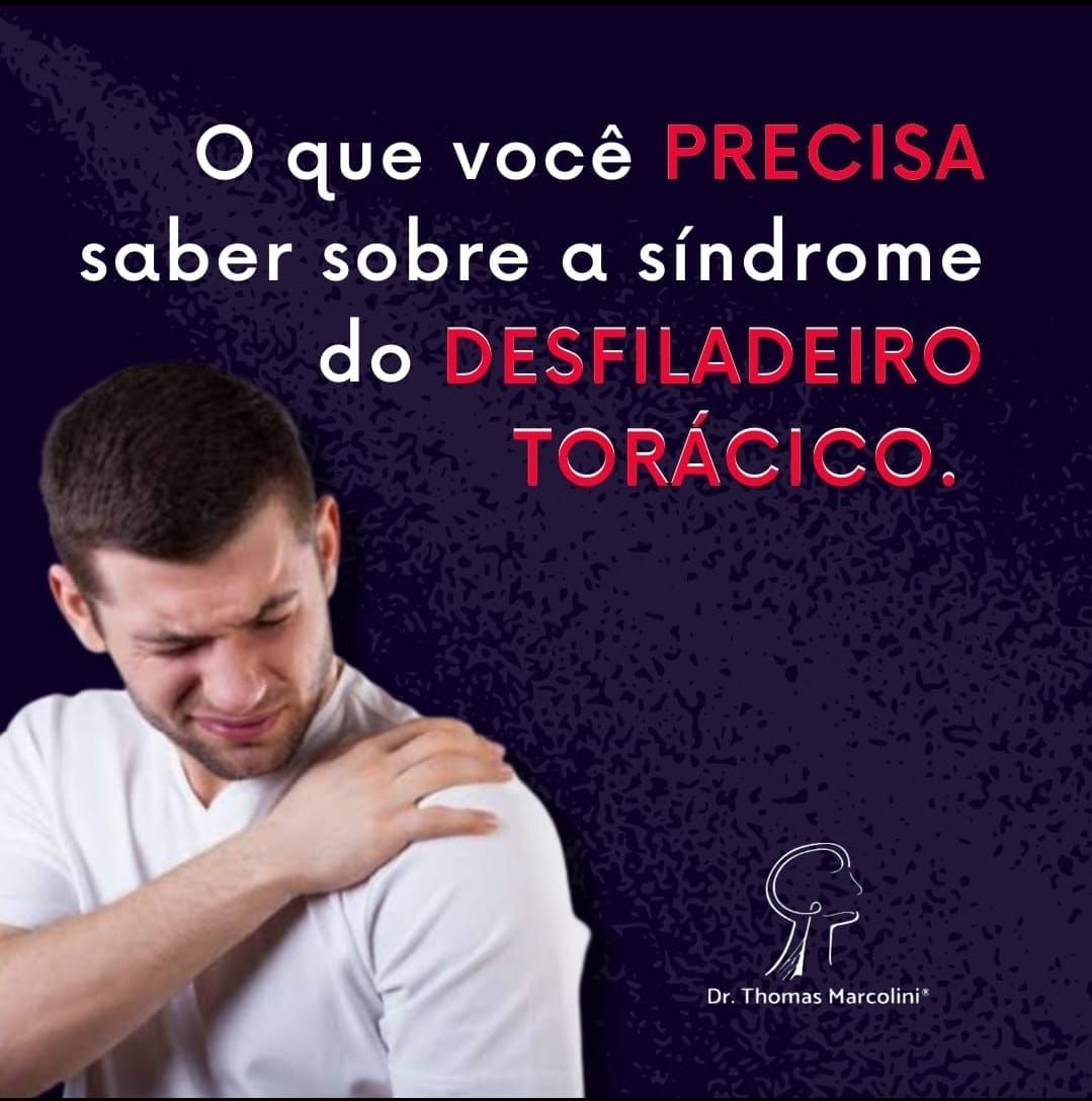 Tudo o que você precisa saber sobre a síndrome do desfiladeiro torácico.