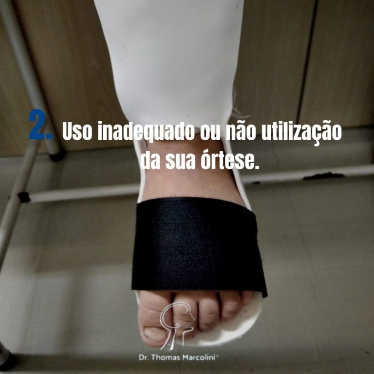 Uso inadequado ou não utilização da sua órtese