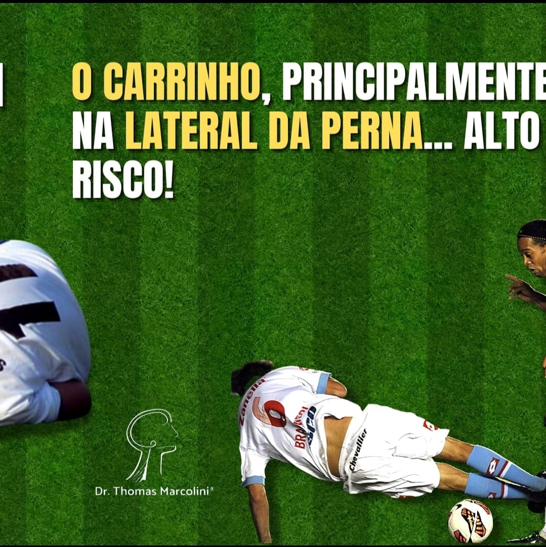 Carrinho no futebol causa pé caído.