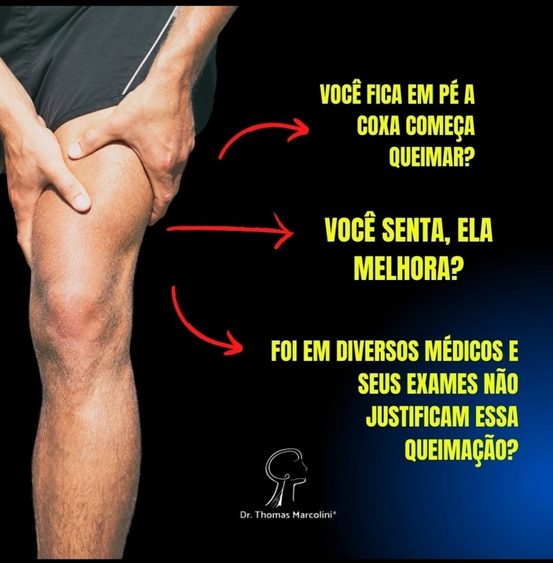 Queimação na Coxa pode ser Meralgia Parestésica!