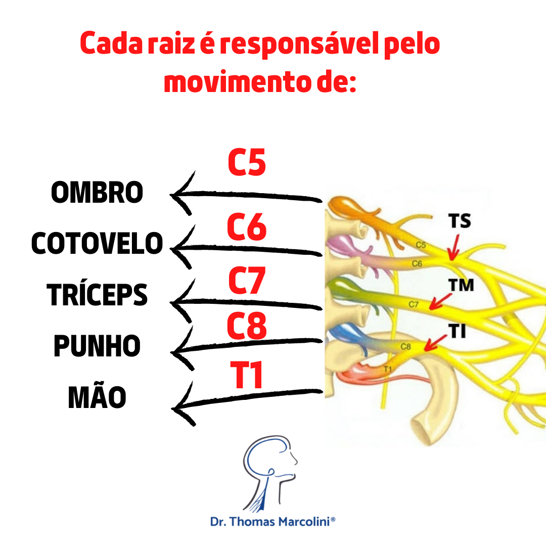 lesão do plexo braquial