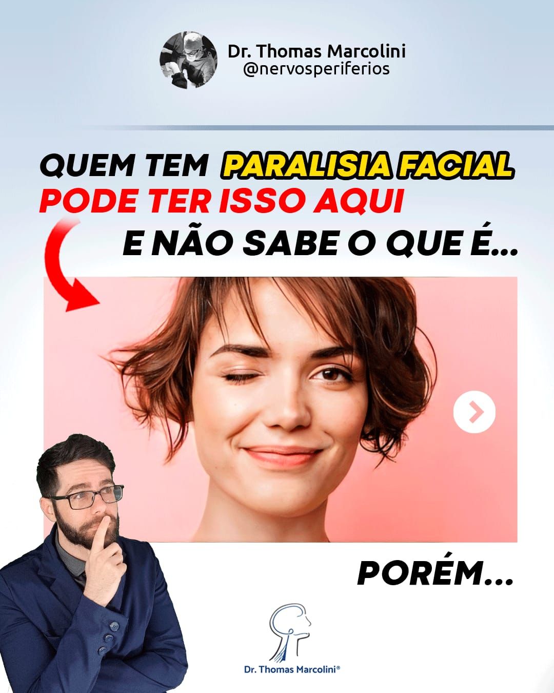 O que é sincinesia?