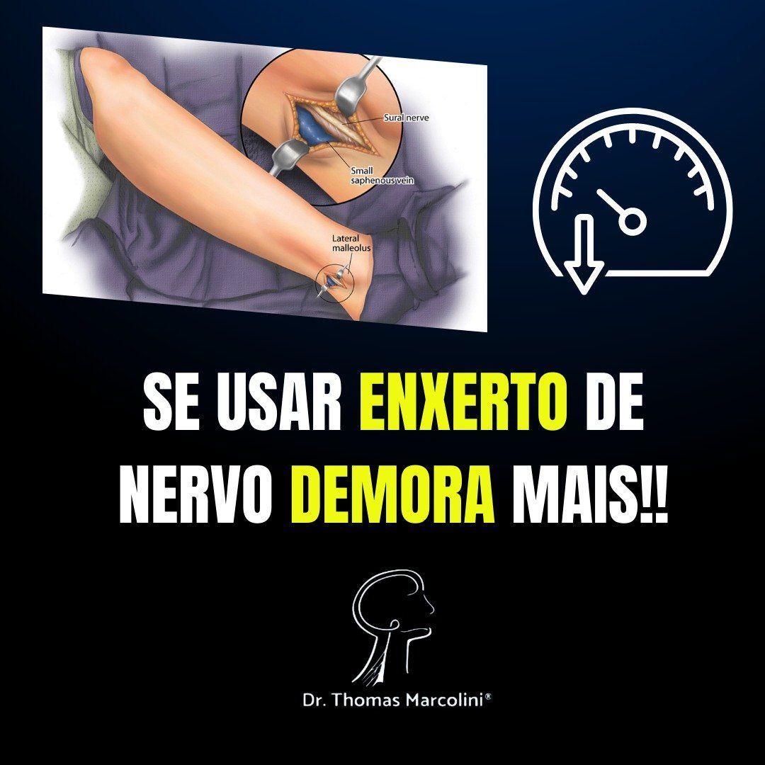 Tempo de recuperação após enxerto de um nervo.