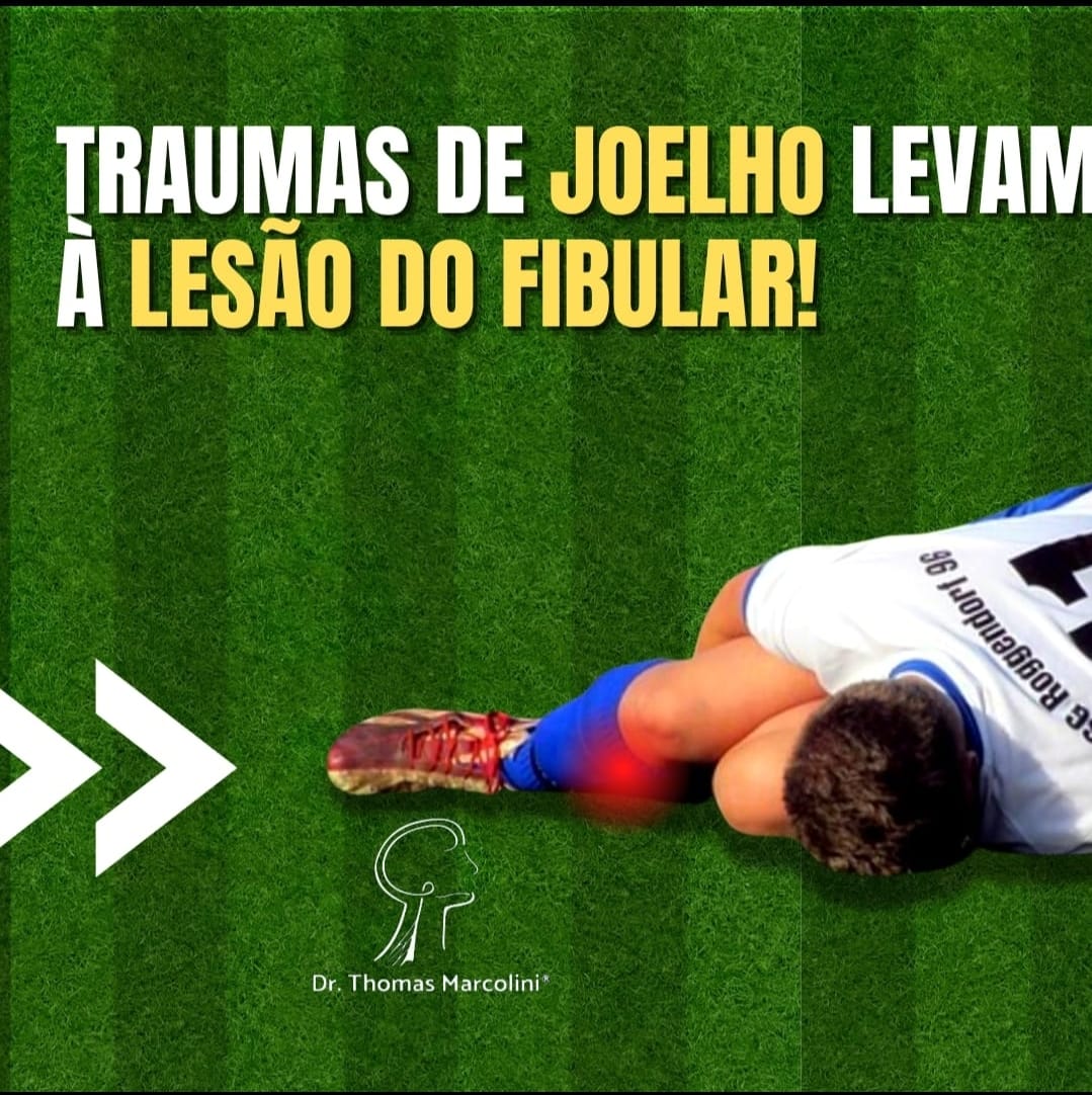 Fratura de joelho causa pé caído.