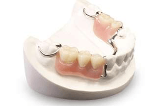 Partial denture on a white model, showing pink gum-colored base and attached artificial teeth with metal clasps.