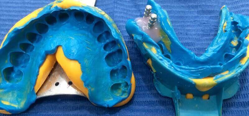 ODONTOLOGÍA RESTAURATIVA Y PROTÉSICA