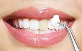 Ortodontija