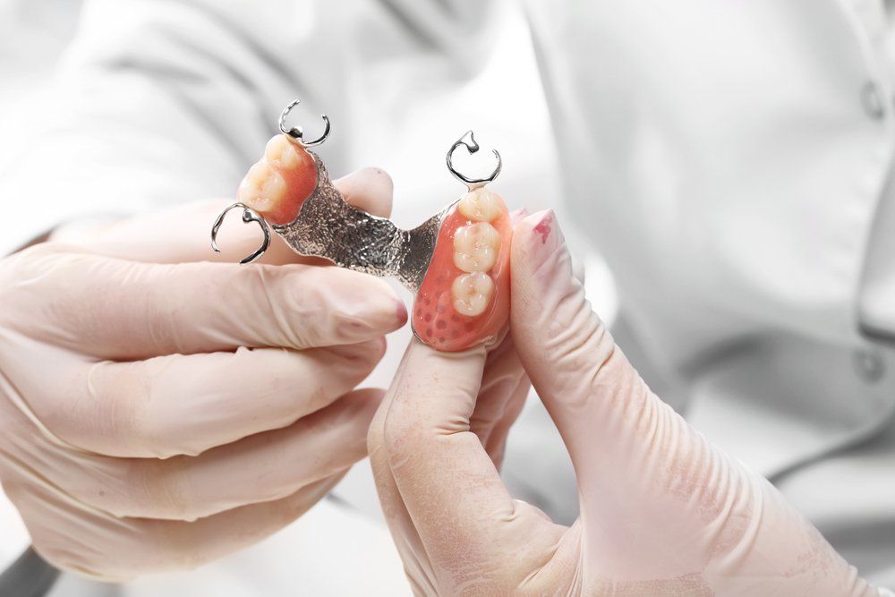 Zobu protezēšanas veidi