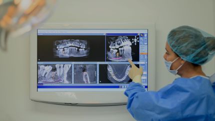 UNIDAD DE TOMOGRAFÍA DENTAL UTD - ESCANEOS Y RADIOGRAFÍAS ESPECIALIZADAS