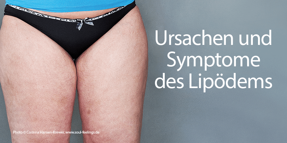 Ursachen und Symptome des Lipödems - LipoZentrum Dr. Heck in Salzburg