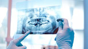 Dental Exam — Tooth X-ray Result in Redding, CA