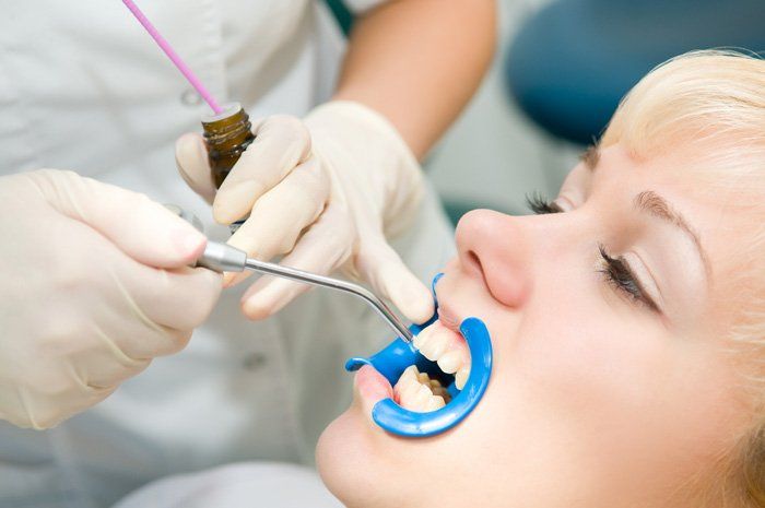 Dental Sealants