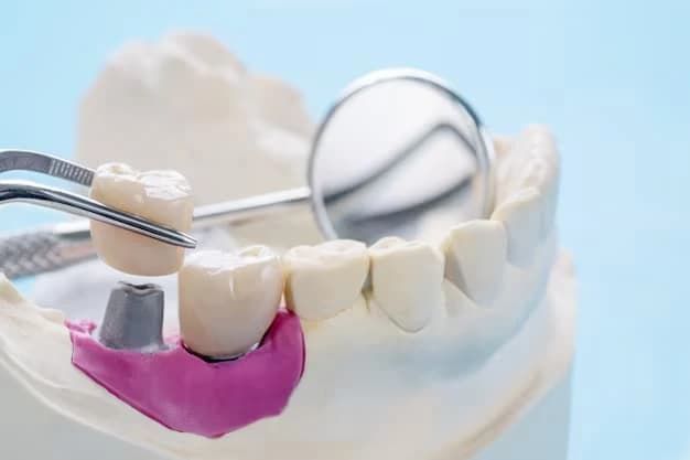 Dental Crowns in Lake Mary

