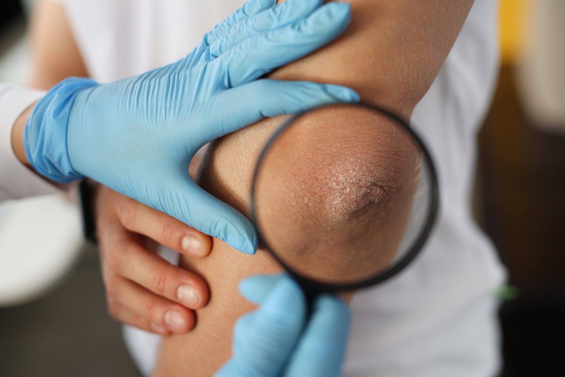 Examining Patient's Elbow — Farmington Hills, MI — Farmington Hills Dermatology