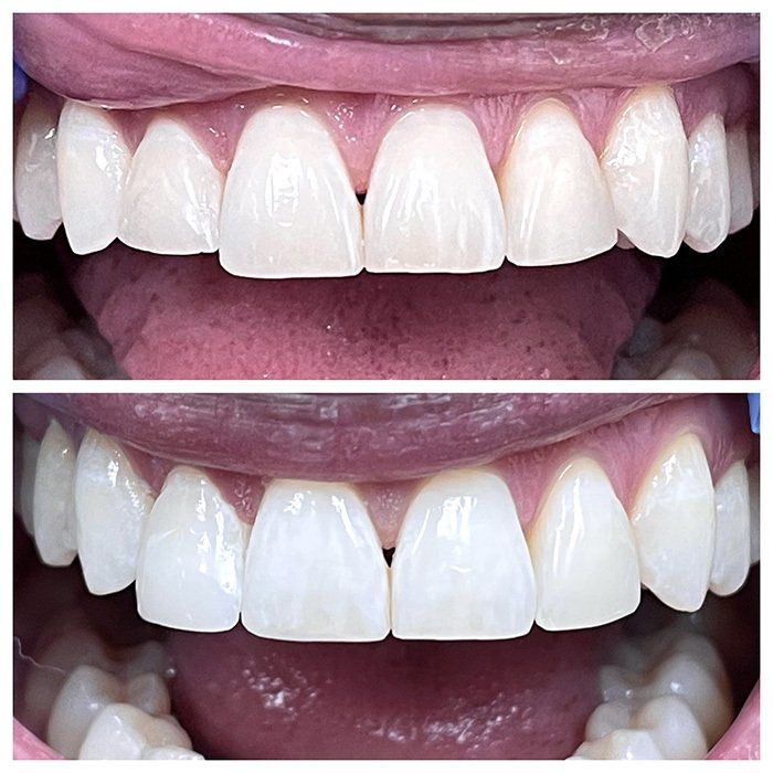 Example of cosmetic dentistry results