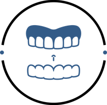 illustration of top teeth with a clear aligner being applied