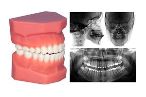 dentures