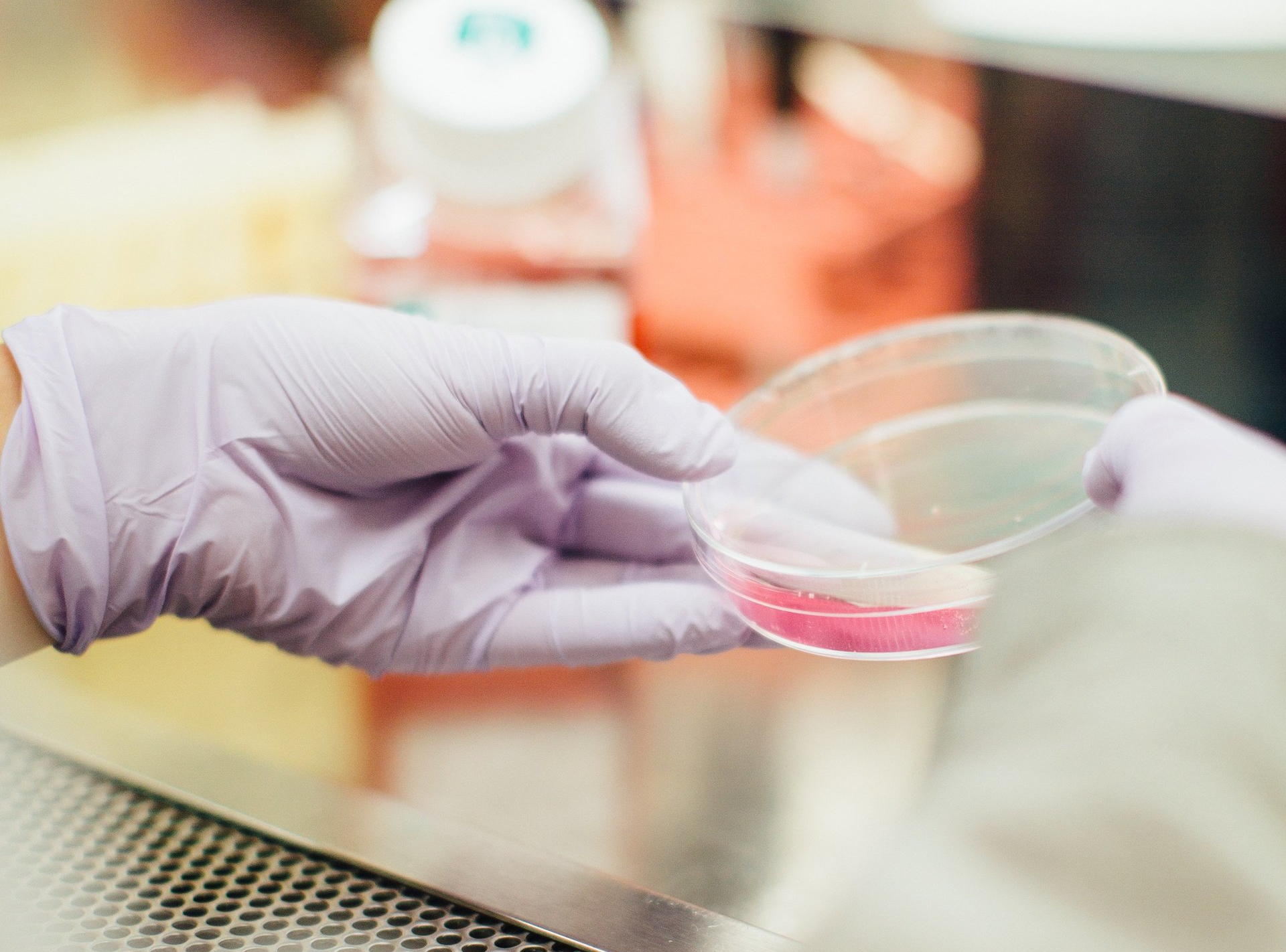 Bacterial Petri Dish in Lab