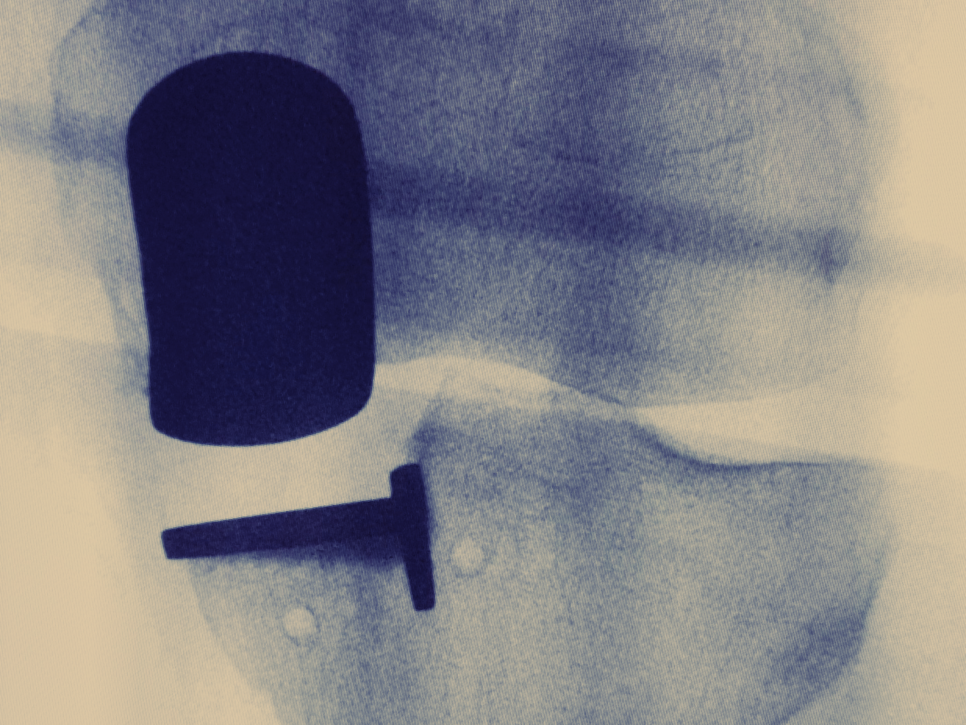 Radiografia de prótese parcial de joelho