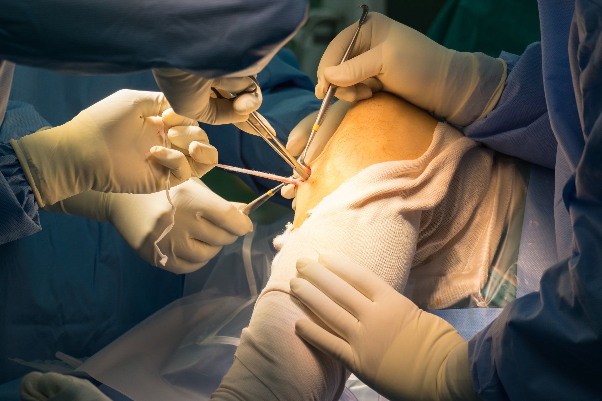 Cirurgia de reconstrução do ligamento cruzado anterior