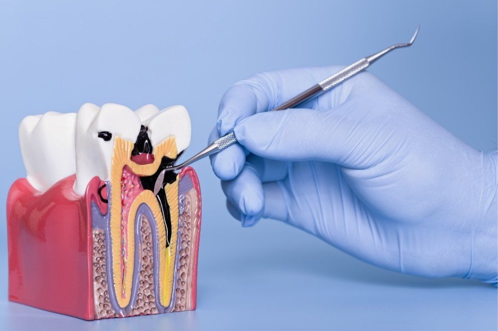 Parodontite: Studio Dentistico Vecchiotti Cesena 0547 24741