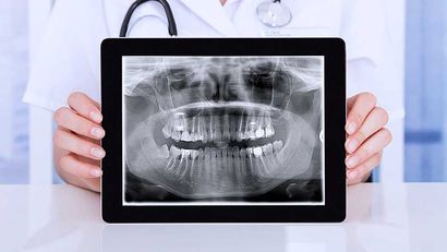 Radiologia Digitale: Studio Dentistico Vecchiotti dr. Marco Cesena
