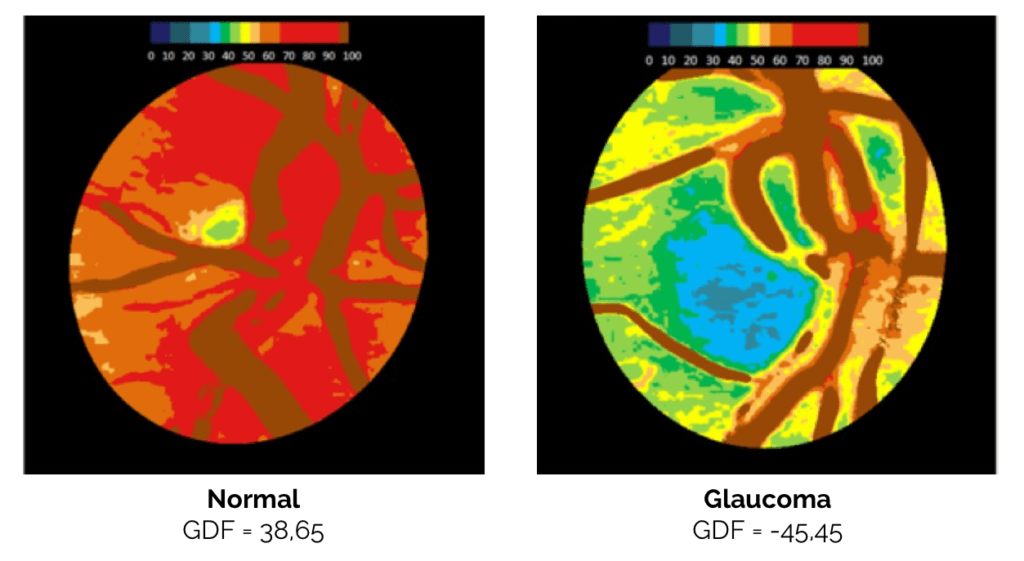 FAQ und Support RetinaLyze