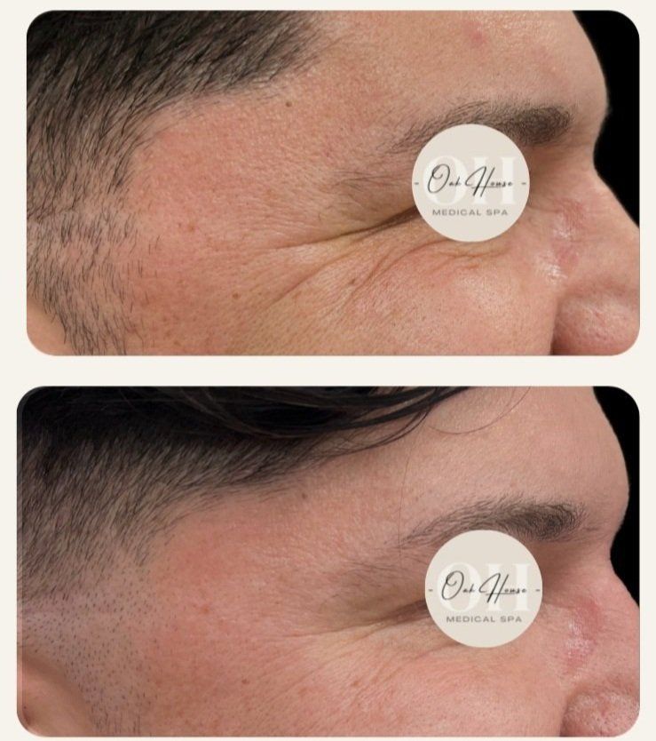 A before and after photo of a man 's face A before and after photo of a man 's face