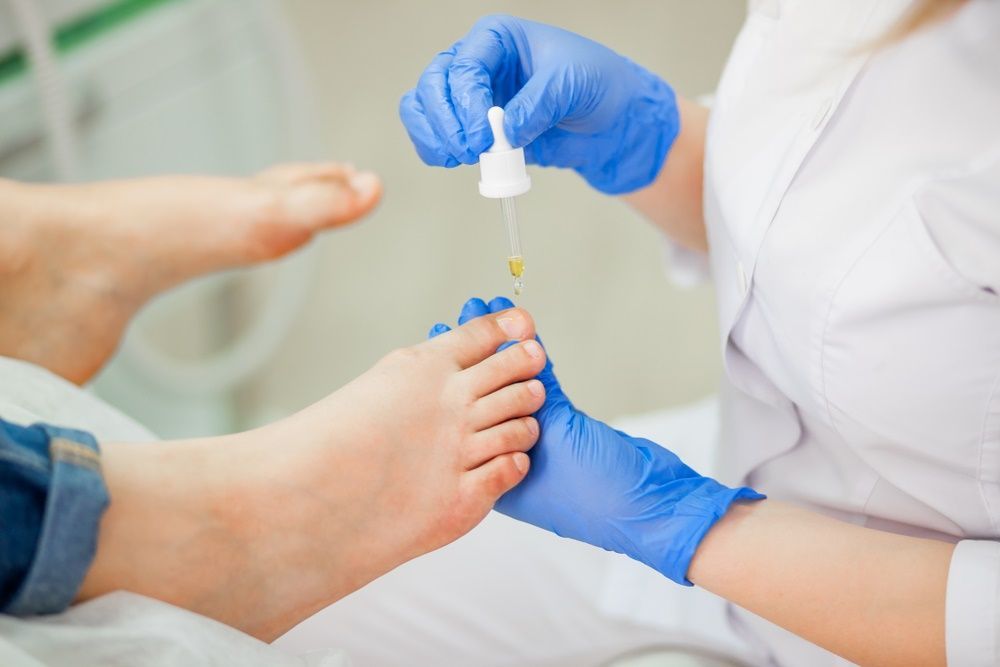 A Doctor is Applying a Dropper to a Patient's Foot — Maitland Central Podiatry in Maitland NSW