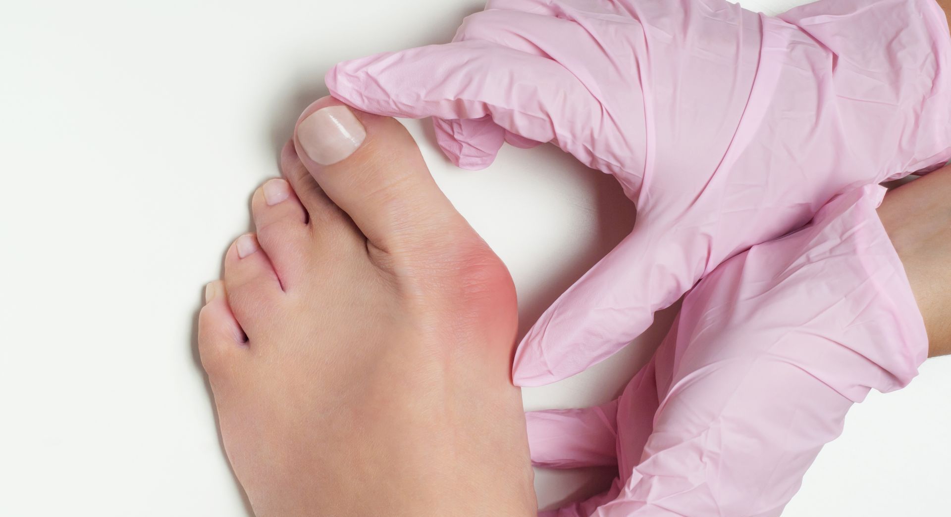 Achilles Tendon Injury Baton Rouge