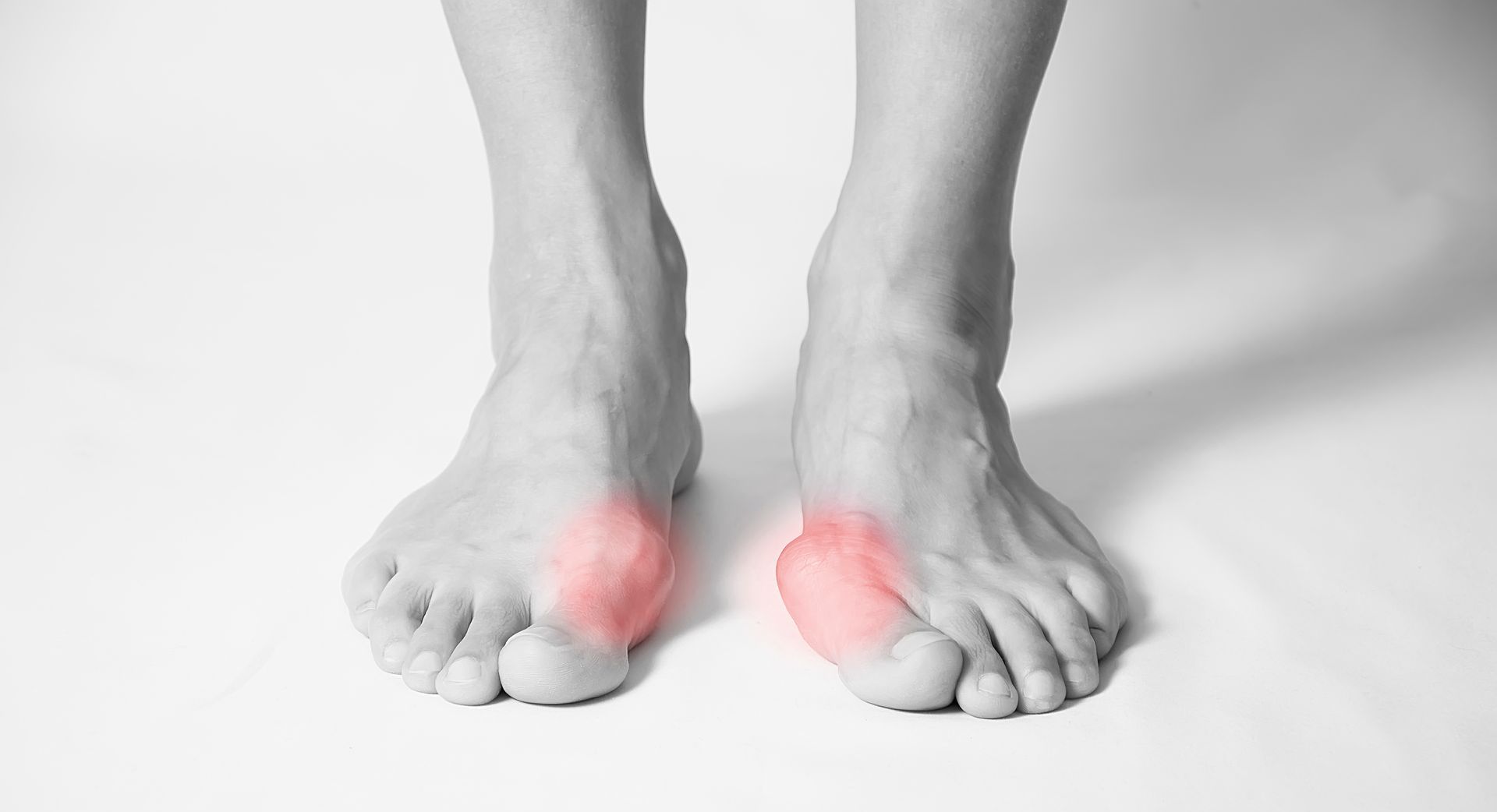 Achilles Tendon