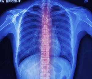 Chiropractic | Xray | Foster RI