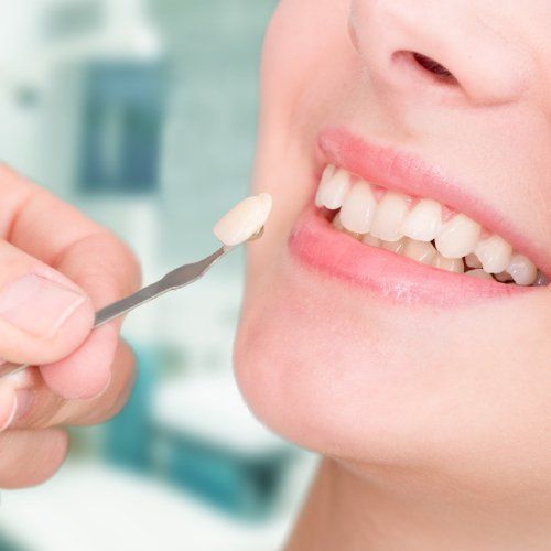 doctor comparing woman teeth color