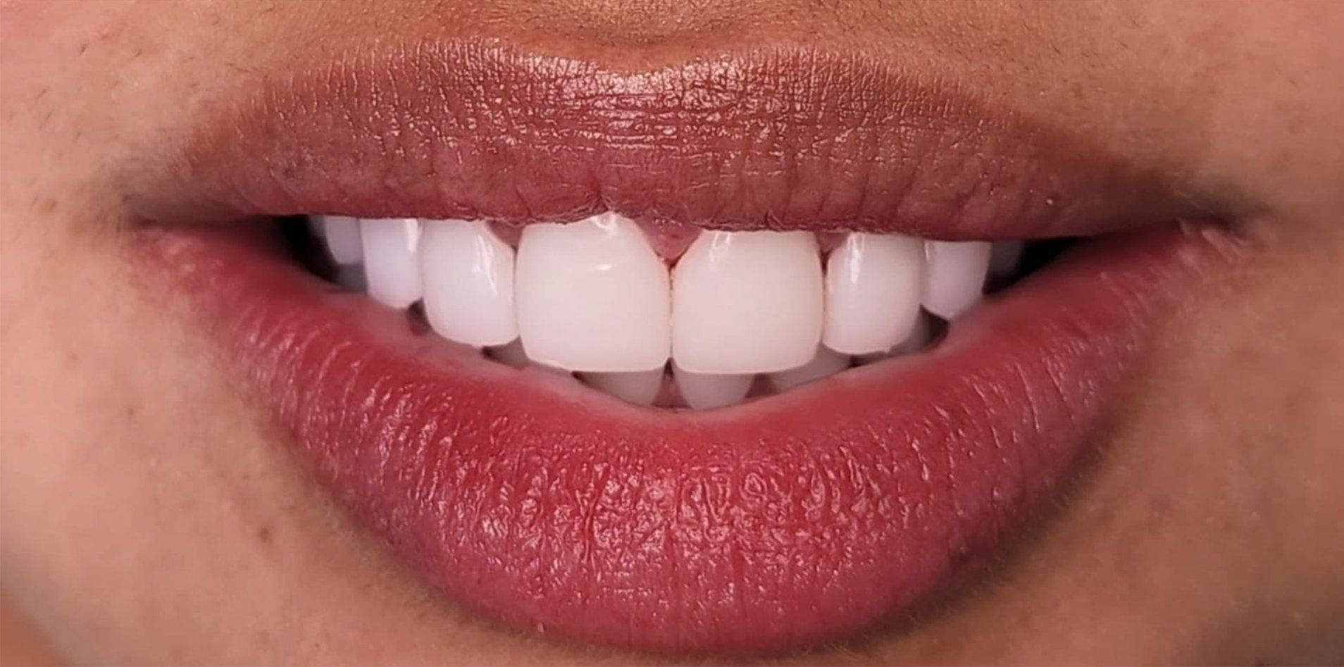 A close up of a woman 's mouth with white teeth and red lips.