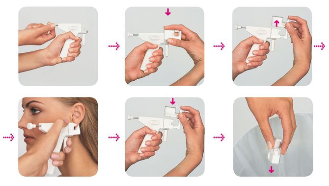 diagram showing the 6 steps of medical ear piercing