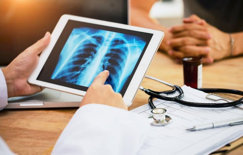 radiografia ai polmoni