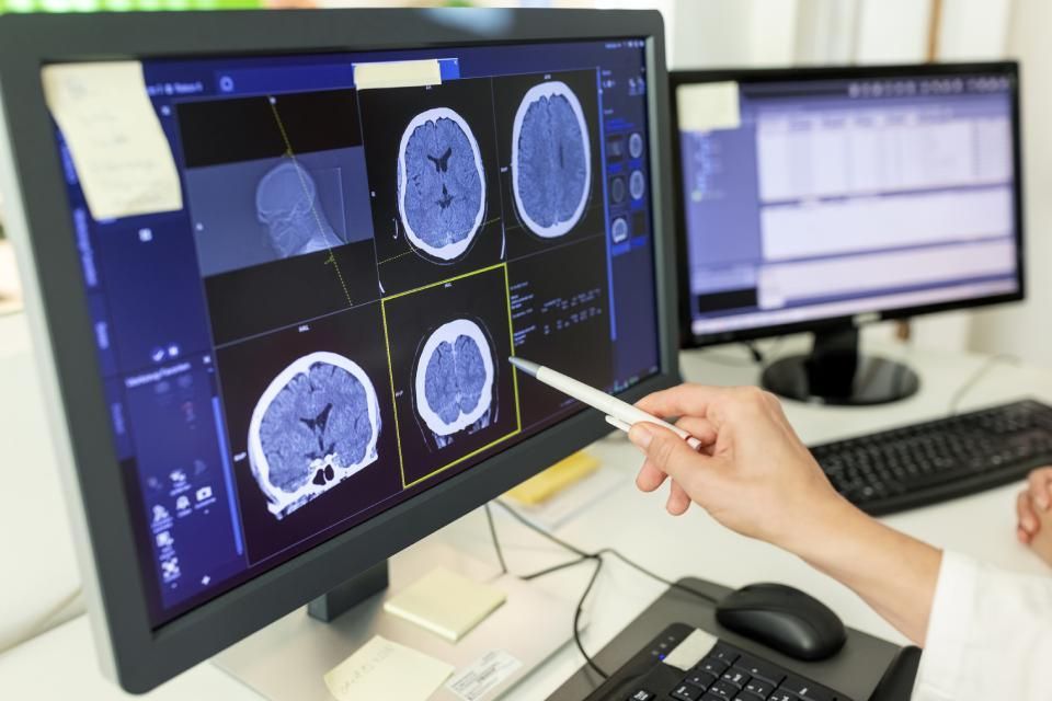 screening neurologici