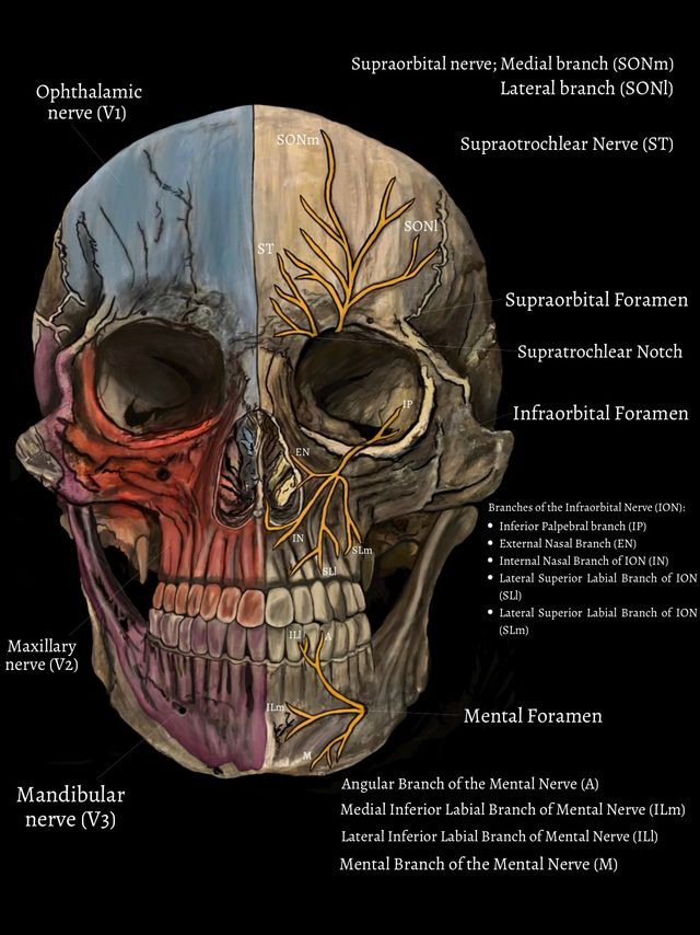 Mandibular Nerve Entrapment