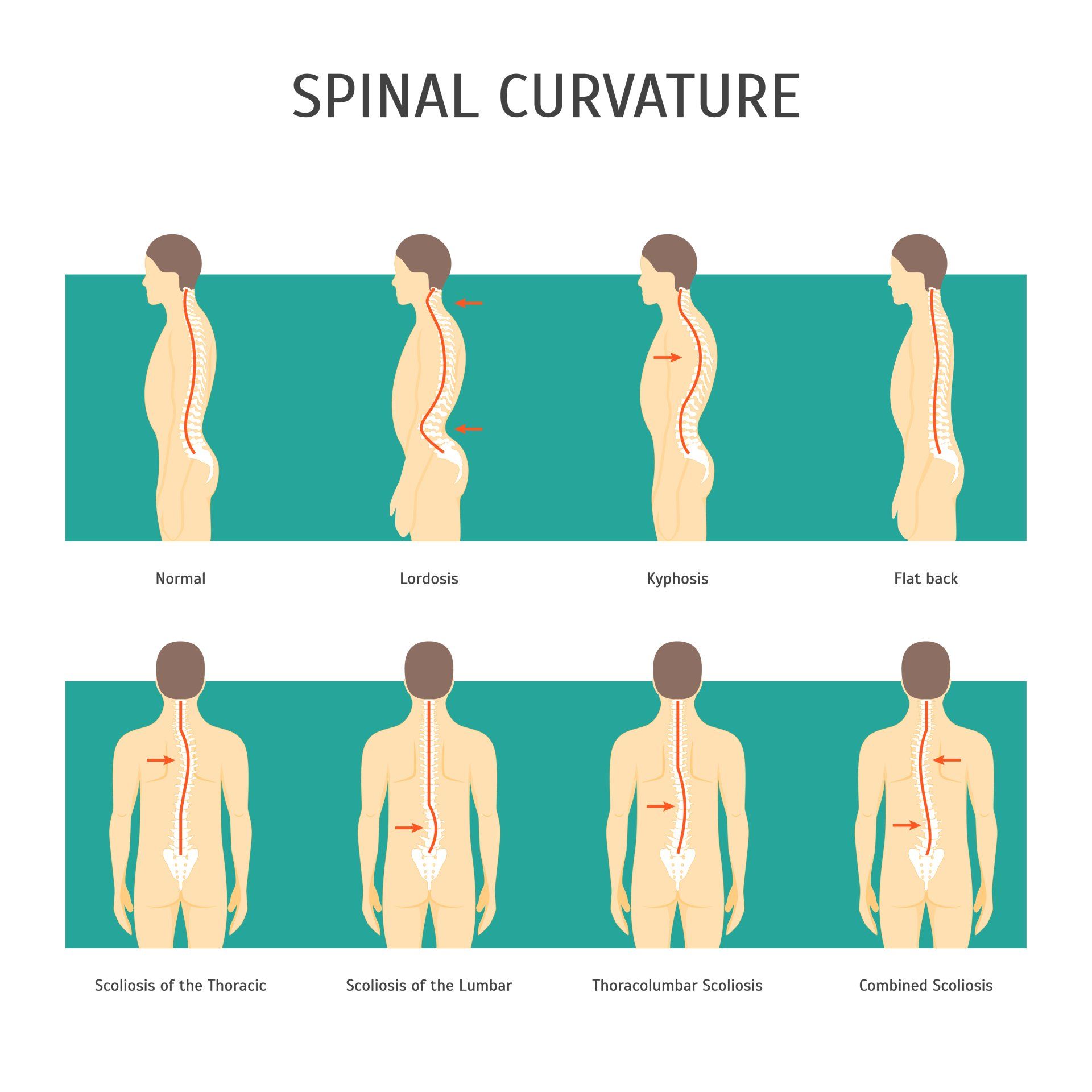Curvatures of the spine